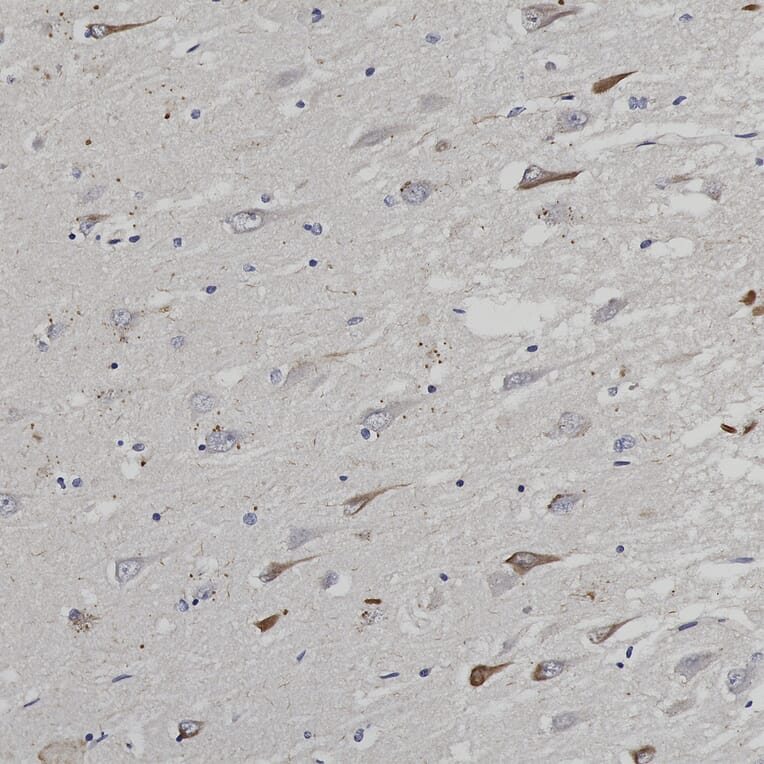 Immunohistochemistry - Anti-Ubiquitin Antibody (A85455) - Antibodies.com