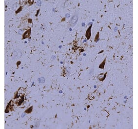 Immunohistochemistry - Anti-Ubiquitin Antibody [Ubi-1] (A85456) - Antibodies.com