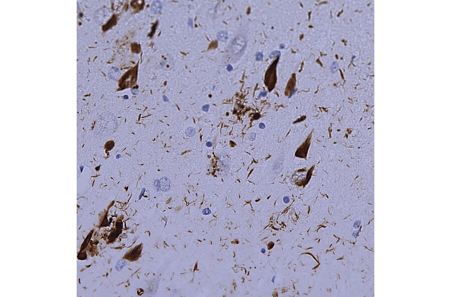 Immunohistochemistry - Anti-Ubiquitin Antibody [Ubi-1] (A85456) - Antibodies.com