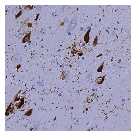 Immunohistochemistry - Anti-Ubiquitin Antibody [Ubi-1] (A85456) - Antibodies.com