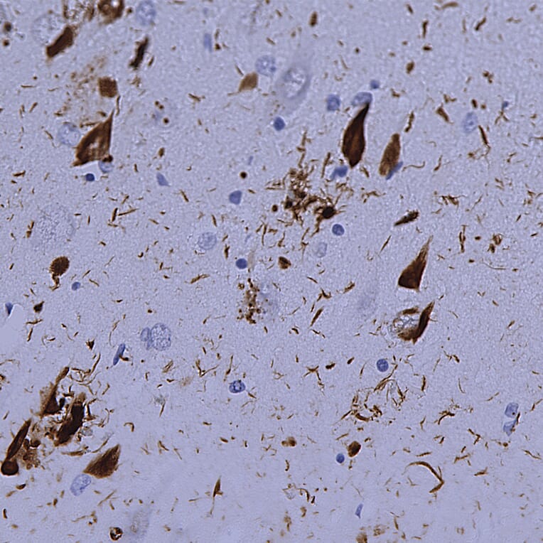 Immunohistochemistry - Anti-Ubiquitin Antibody [Ubi-1] (A85456) - Antibodies.com