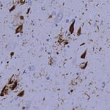 Immunohistochemistry - Anti-Ubiquitin Antibody [Ubi-1] (A85456) - Antibodies.com