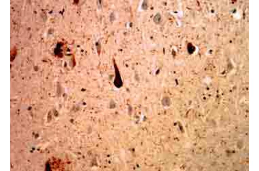 Immunohistochemistry - Anti-Ubiquitin Antibody [Ubi-1] (A85456) - Antibodies.com