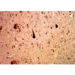 Immunohistochemistry - Anti-Ubiquitin Antibody [Ubi-1] (A85456) - Antibodies.com