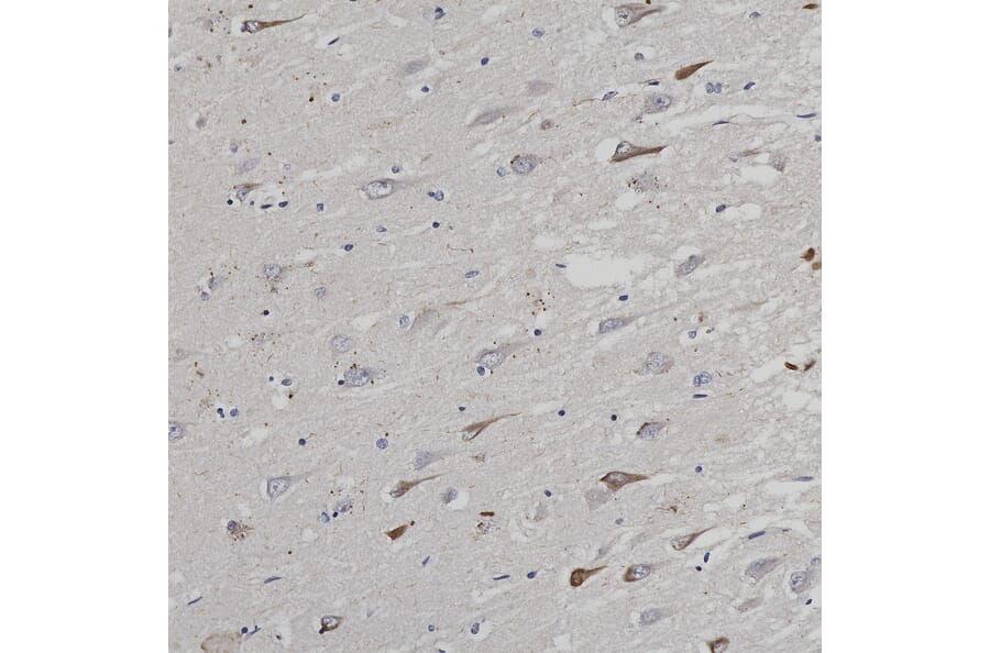 Immunohistochemistry - Anti-Ubiquitin Antibody [Ubi-1] (A85456) - Antibodies.com