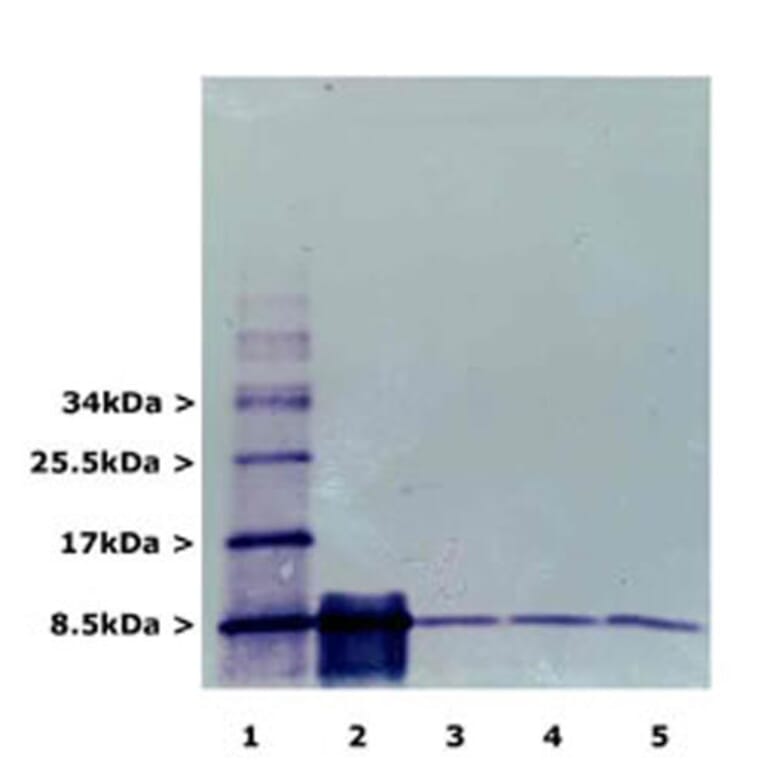 Western Blot - Anti-Ubiquitin Antibody [Ubi-1] (A85456) - Antibodies.com