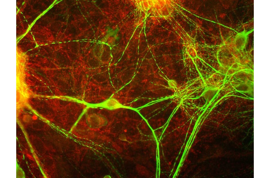 Immunofluorescence - Anti-MARCKS Antibody (A85457) - Antibodies.com