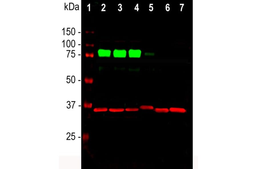 Western Blot - Anti-MARCKS Antibody (A85457) - Antibodies.com