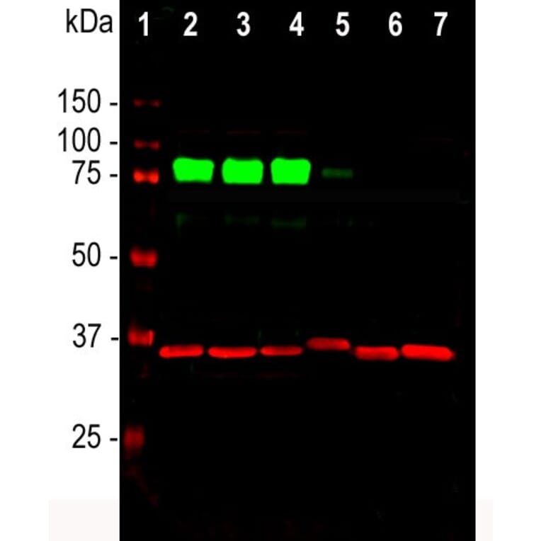 Western Blot - Anti-MARCKS Antibody (A85457) - Antibodies.com