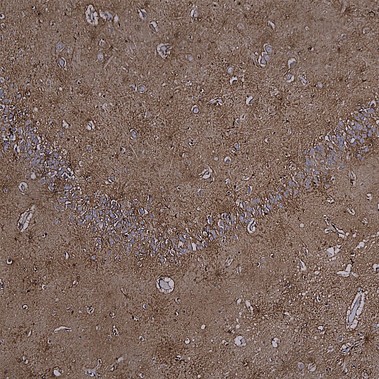 Immunohistochemistry - Anti-MARCKS Antibody (A85457) - Antibodies.com