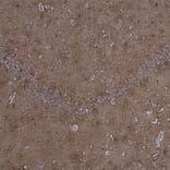 Immunohistochemistry - Anti-MARCKS Antibody (A85457) - Antibodies.com