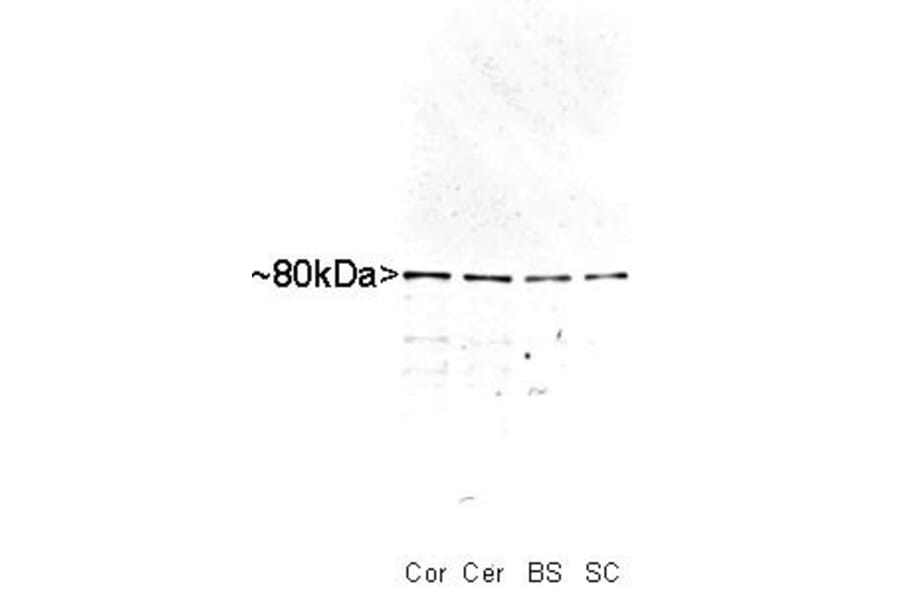 Western Blot - Anti-MARCKS Antibody (A85457) - Antibodies.com