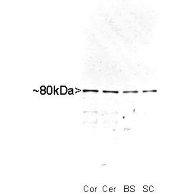 Western Blot - Anti-MARCKS Antibody (A85457) - Antibodies.com