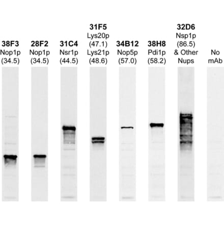 Western Blot - Anti-Nsp1p Antibody (A85458) - Antibodies.com