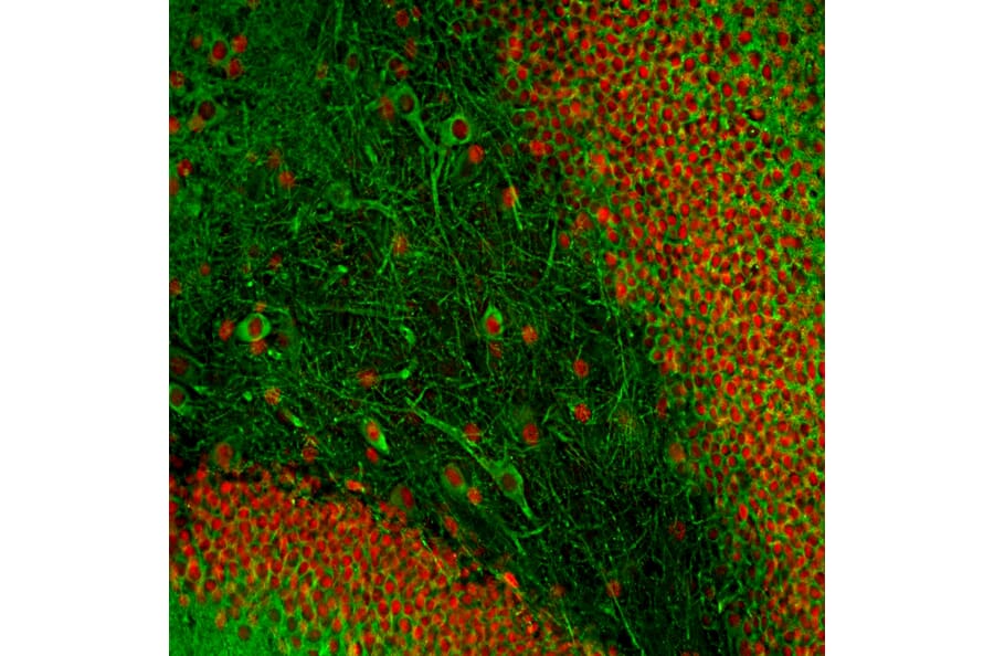 Immunofluorescence - Anti-MAP2 Antibody [2C4] (A85459) - Antibodies.com