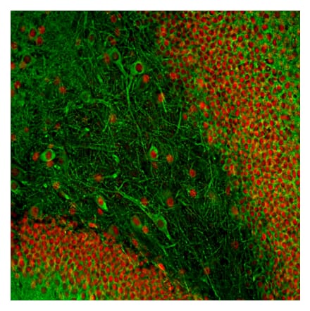 Immunofluorescence - Anti-MAP2 Antibody [2C4] (A85459) - Antibodies.com