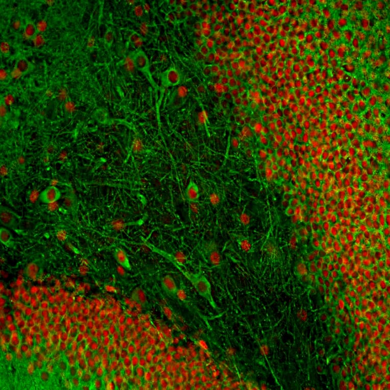 Immunofluorescence - Anti-MAP2 Antibody [2C4] (A85459) - Antibodies.com