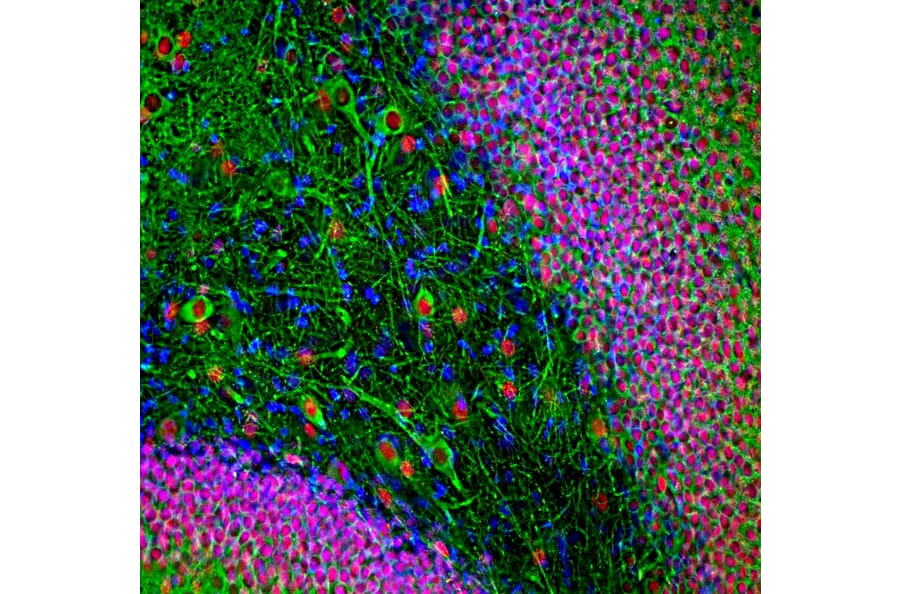 Immunofluorescence - Anti-MAP2 Antibody [2C4] (A85459) - Antibodies.com