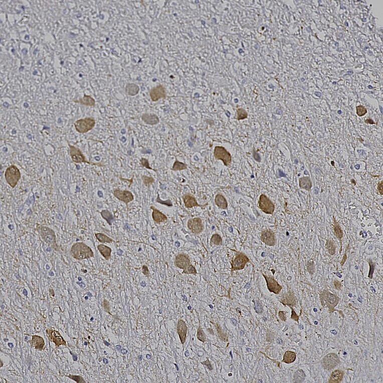 Immunohistochemistry - Anti-MAP2 Antibody [2C4] (A85459) - Antibodies.com