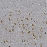 Immunohistochemistry - Anti-MAP2 Antibody [2C4] (A85459) - Antibodies.com