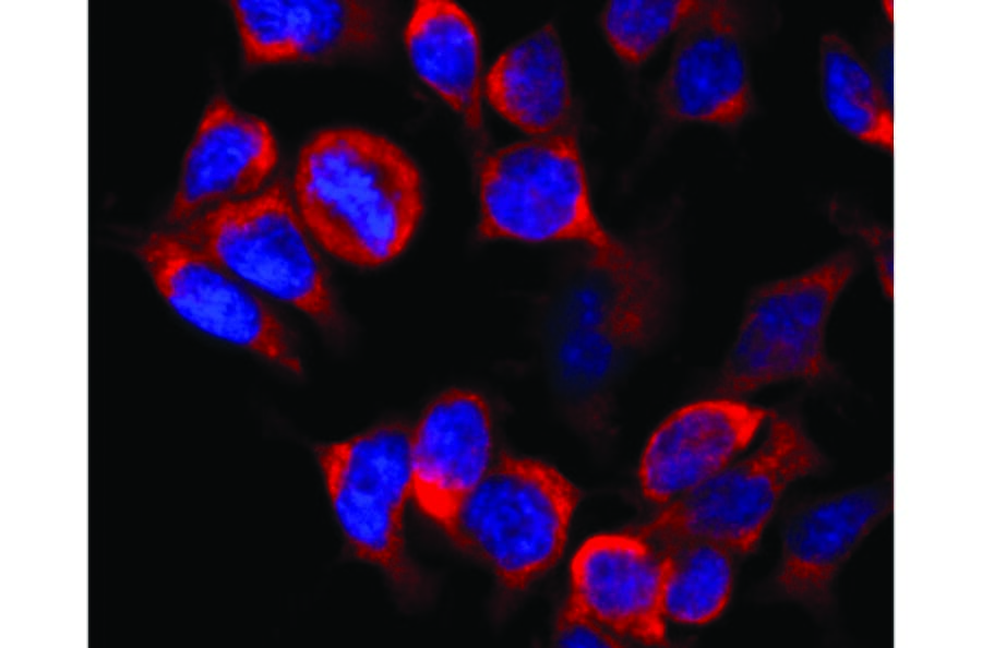 Immunocytochemistry - Anti-Kinesin Heavy Chain Antibody [KN-02] (A85466) - Antibodies.com