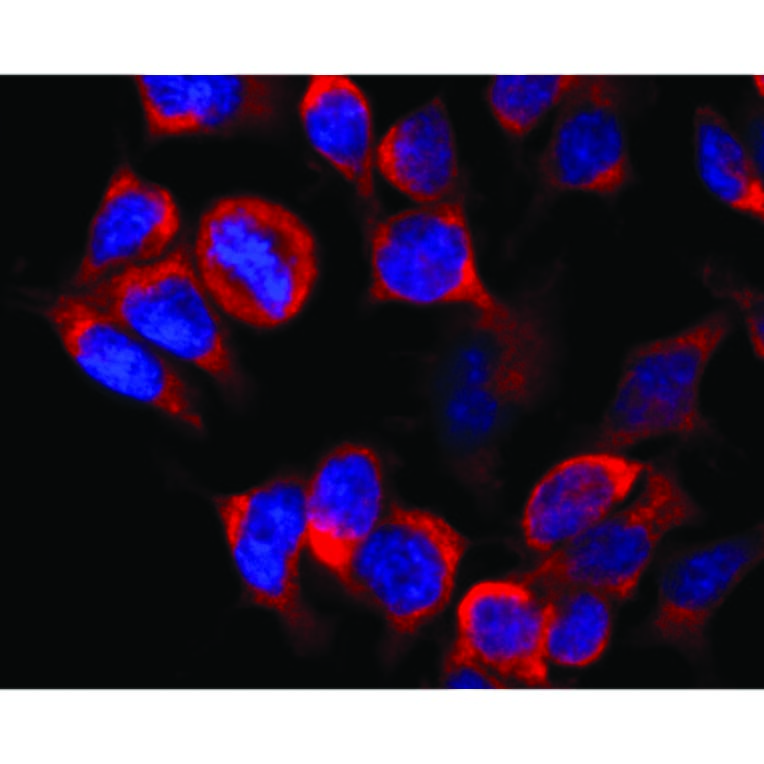 Immunocytochemistry - Anti-Kinesin Heavy Chain Antibody [KN-02] (A85466) - Antibodies.com