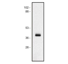 WB - Anti-HLA Class I Antibody [MEM-147] (A85472)