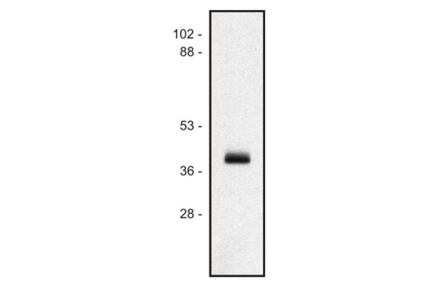 WB - Anti-HLA Class I Antibody [MEM-147] (A85472)