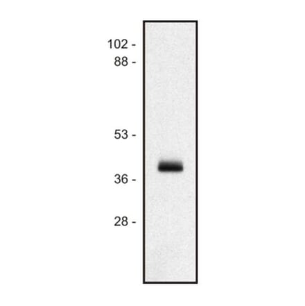 WB - Anti-HLA Class I Antibody [MEM-147] (A85472)