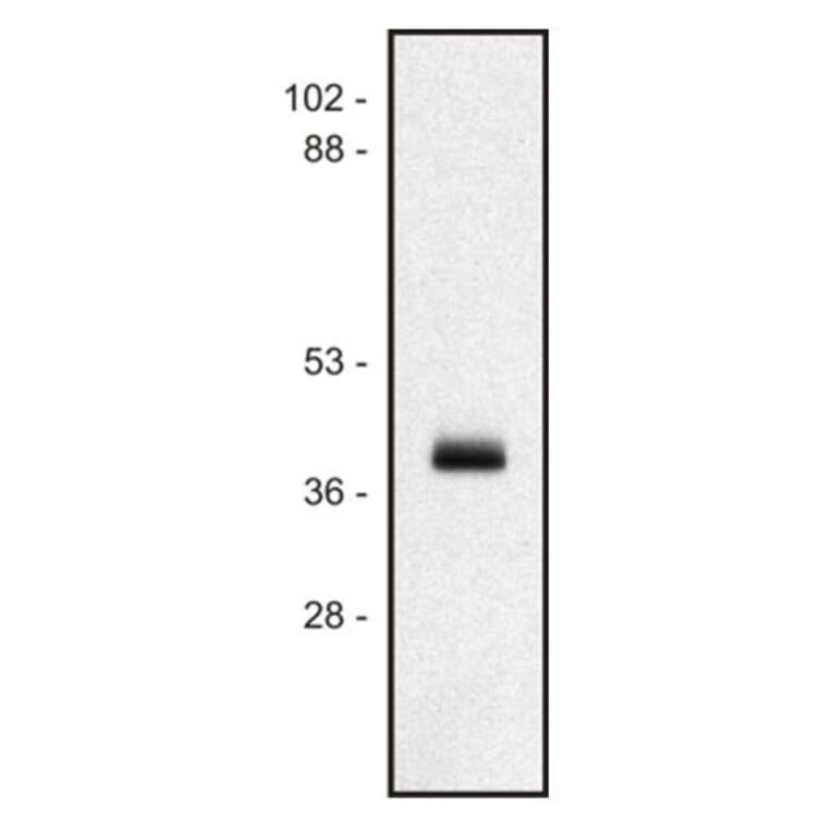 WB - Anti-HLA Class I Antibody [MEM-147] (A85472)
