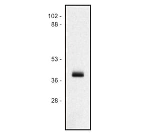 Western Blot - Anti-HLA Class I Antibody [MEM-147] (A85469) - Antibodies.com