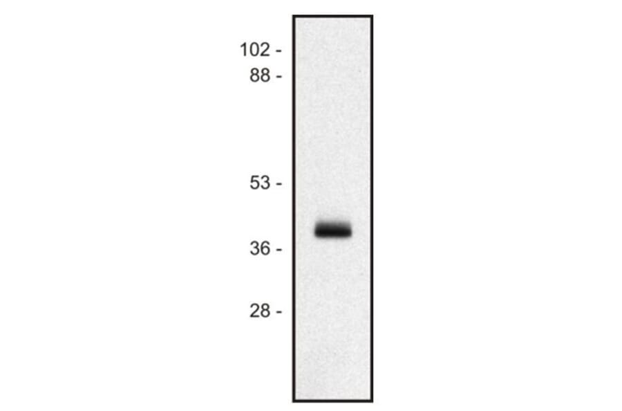 Western Blot - Anti-HLA Class I Antibody [MEM-147] (A85469) - Antibodies.com