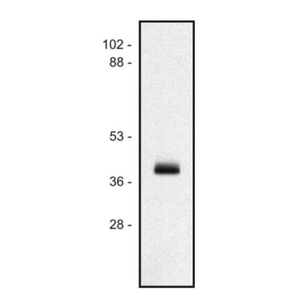 Western Blot - Anti-HLA Class I Antibody [MEM-147] (A85469) - Antibodies.com