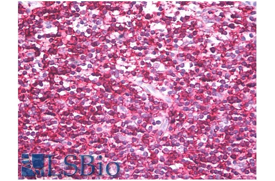 IHC - Anti-CD45RB Antibody [MEM-143] (A85474)