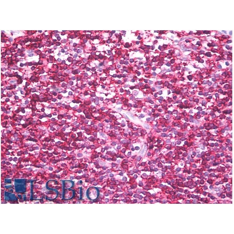 IHC - Anti-CD45RB Antibody [MEM-143] (A85474)