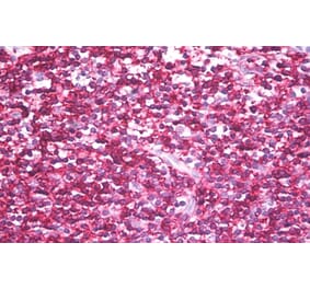 Immunohistochemistry - Anti-CD45RB Antibody [MEM-143] (A85472) - Antibodies.com