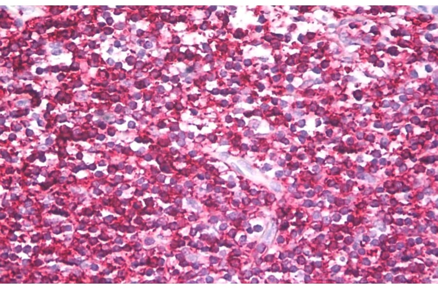 Immunohistochemistry - Anti-CD45RB Antibody [MEM-143] (A85472) - Antibodies.com