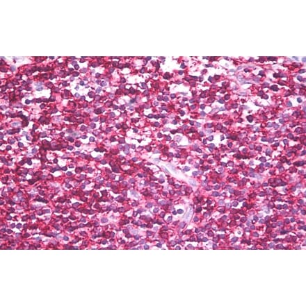 Immunohistochemistry - Anti-CD45RB Antibody [MEM-143] (A85472) - Antibodies.com