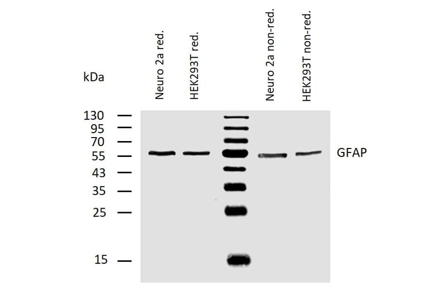 WB - Anti-GFAP Antibody [GF-02] (A85479)