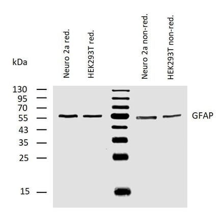WB - Anti-GFAP Antibody [GF-02] (A85479)
