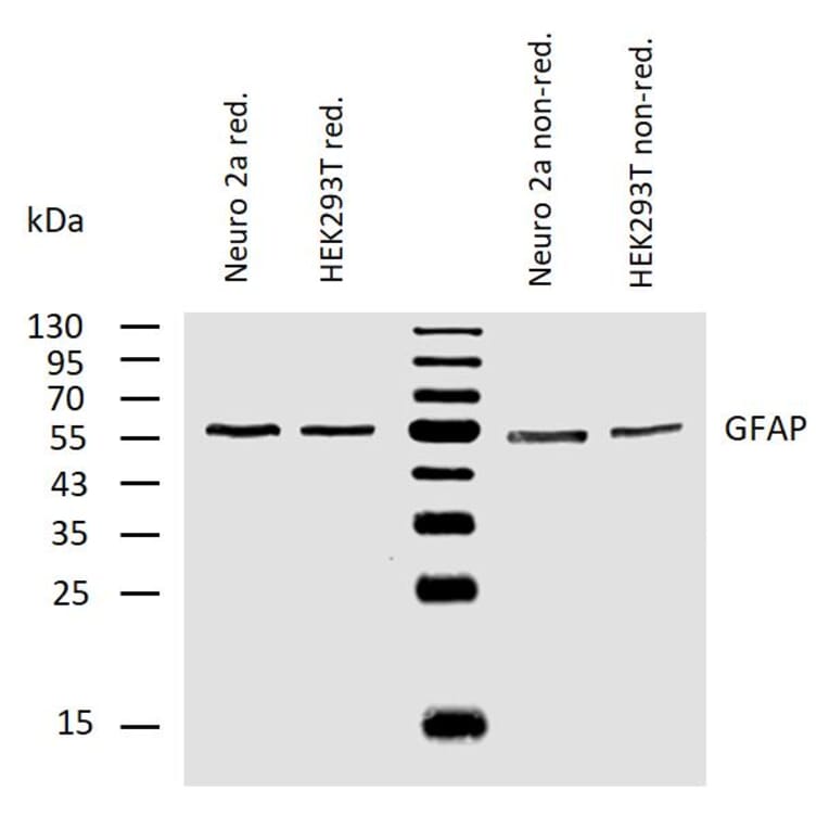 WB - Anti-GFAP Antibody [GF-02] (A85479)