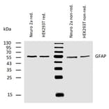 WB - Anti-GFAP Antibody [GF-02] (A85479)