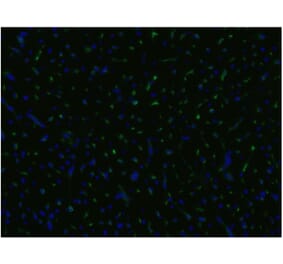 ICC - Anti-CD105 Antibody [MEM-229] (A85494)