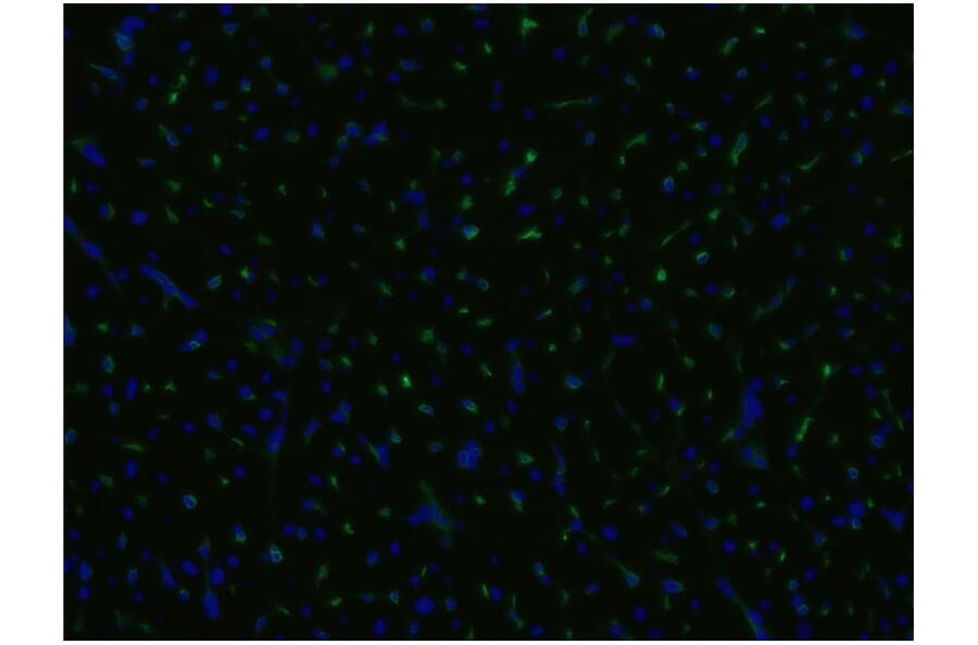 ICC - Anti-CD105 Antibody [MEM-229] (A85494)