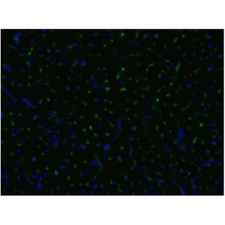 ICC - Anti-CD105 Antibody [MEM-229] (A85494)
