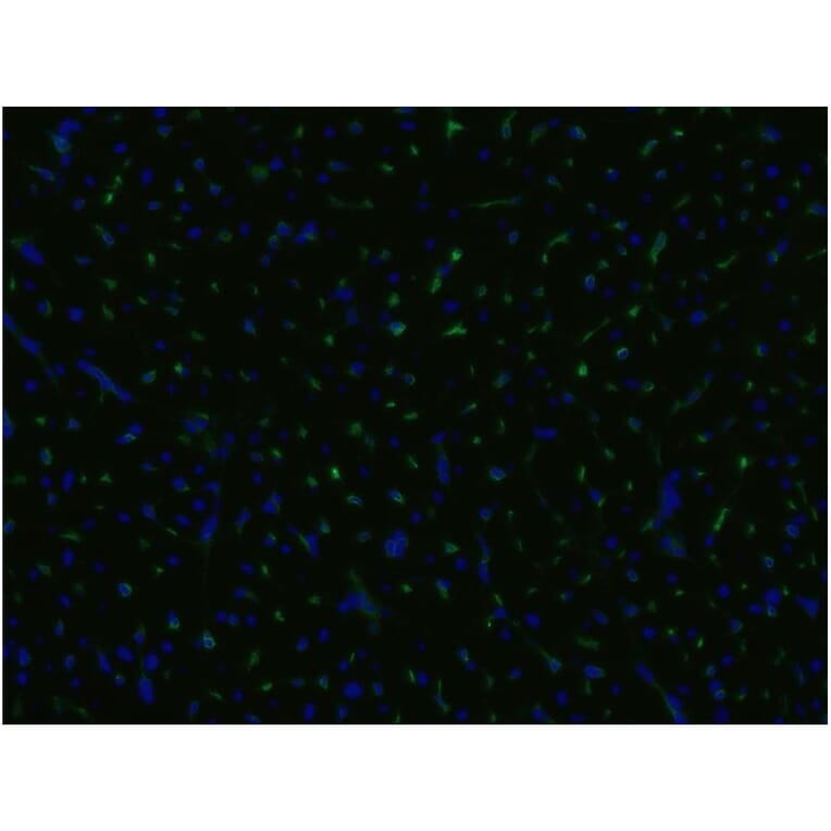 ICC - Anti-CD105 Antibody [MEM-229] (A85494)