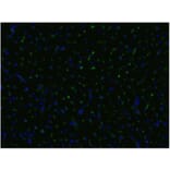 ICC - Anti-CD105 Antibody [MEM-229] (A85494)