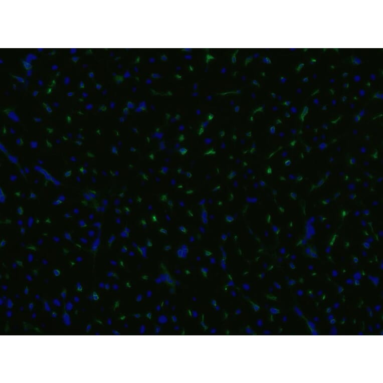 Immunohistochemistry - Anti-CD105 Antibody [MEM-229] (A85493) - Antibodies.com