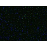 Immunohistochemistry - Anti-CD105 Antibody [MEM-229] (A85493) - Antibodies.com