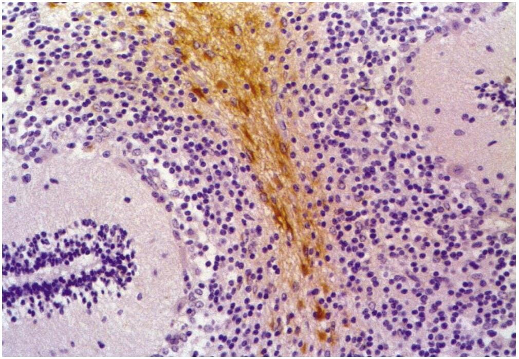 GFAP Antibodies | Antibodies.com